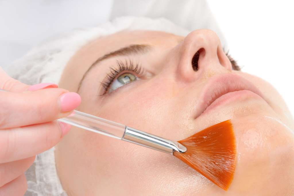 qué es peeling químico