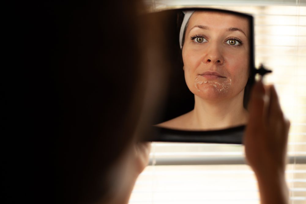 peeling químico facial